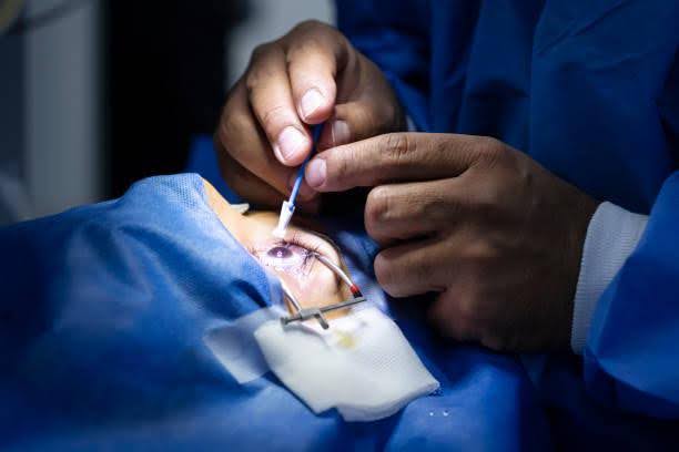 Eye Surgery
