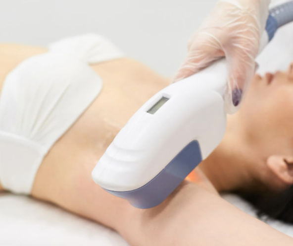 Laser Hair Removal