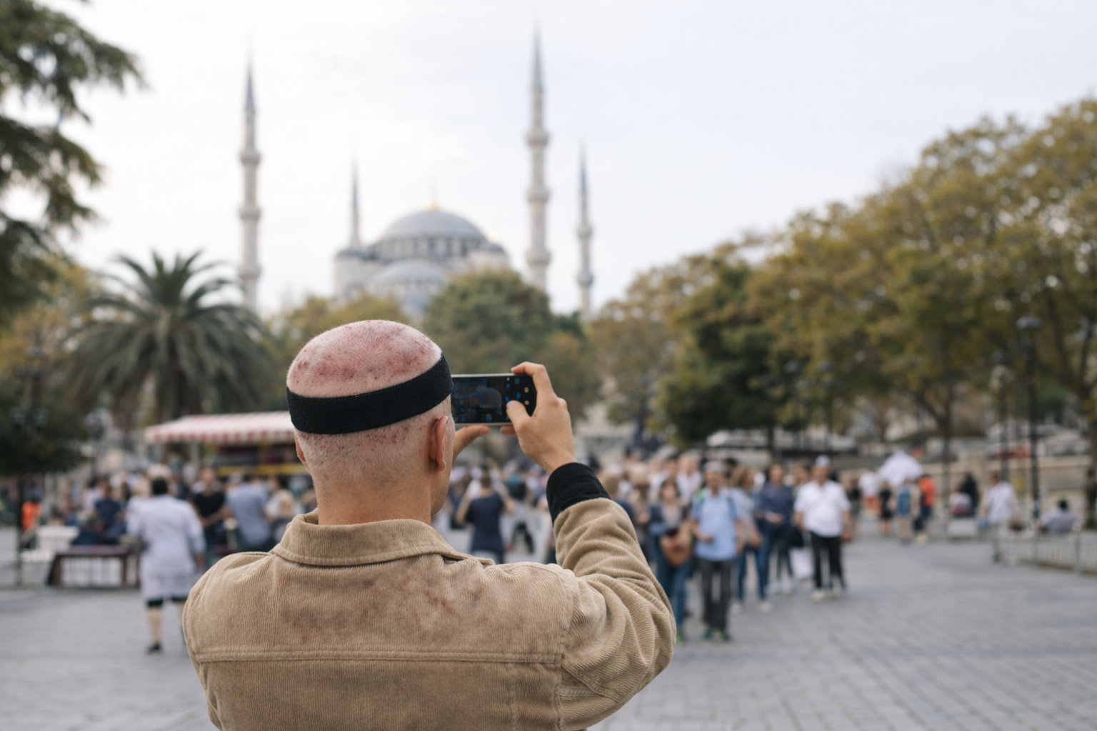 Man visiting Istanbul during a trip for a hair transplant in Turkey